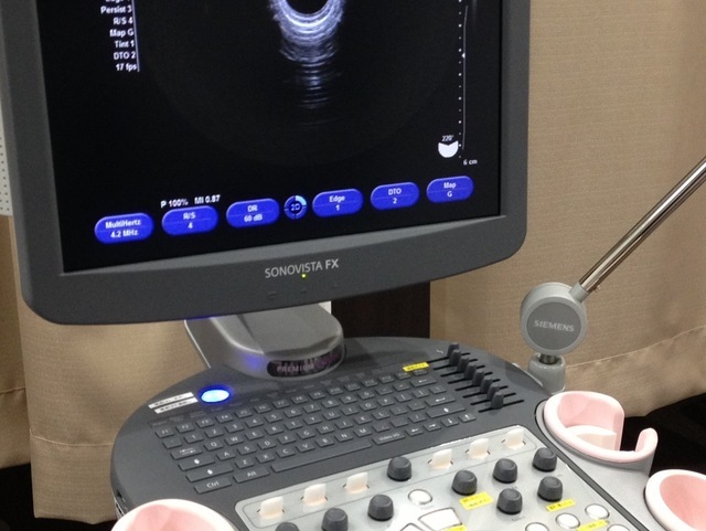 月経時期の超音波検査とホルモン1
